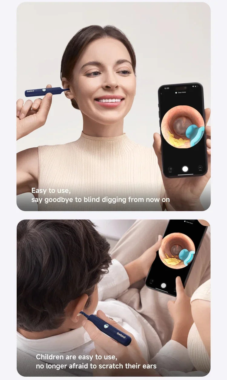Xiaomi Bebird EarSight Plus I35R – 2025 Wireless Ear Cleaner with HD Visual Camera & Tweezers