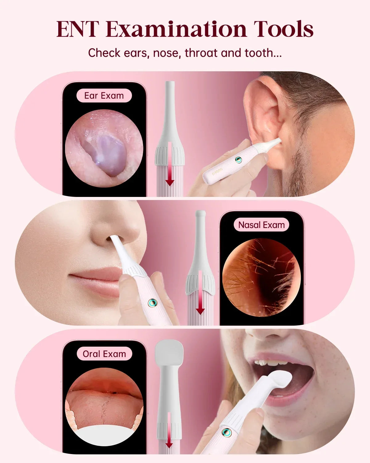 (PINK COLOR) Xiaomi Bebird EarSight Plus I35R – 2025 Wireless Ear Cleaner with HD Visual Camera & Tweezers