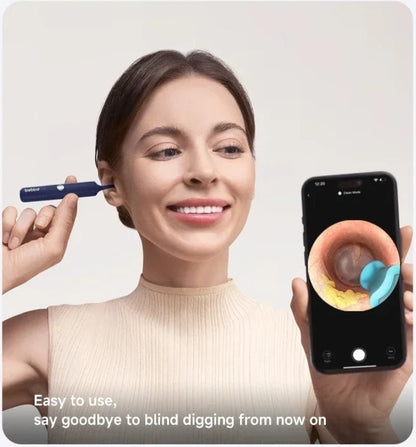(This Week 20% off) Xiaomi Bebird EarSight Plus I35R – 2025 Wireless Ear Cleaner with HD Visual Camera & Tweezers