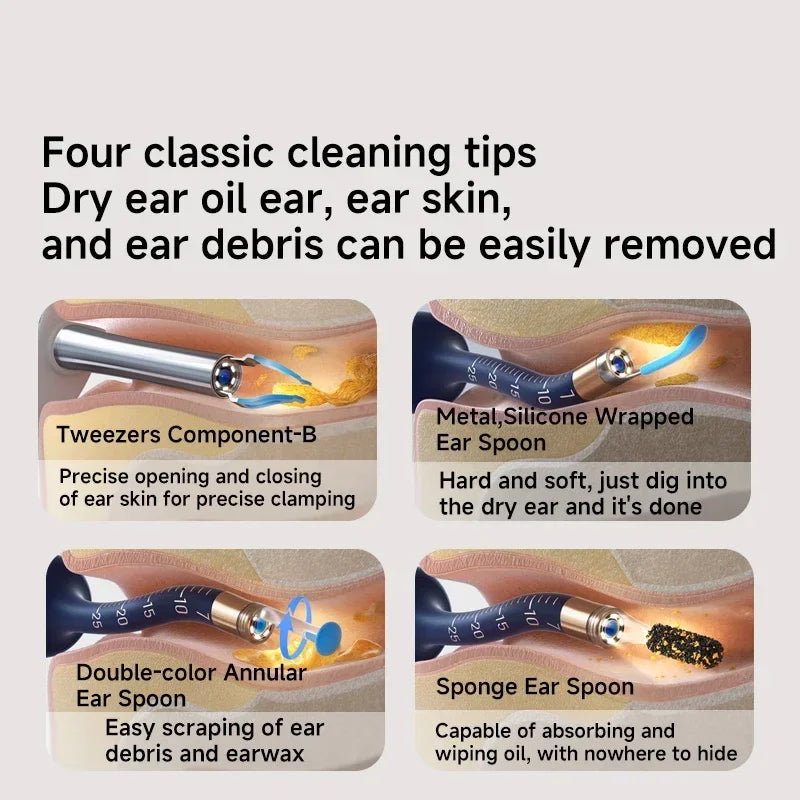 Xiaomi Bebird EarSight Plus I35R – 2025 Wireless Ear Cleaner with HD Visual Camera & Tweezers